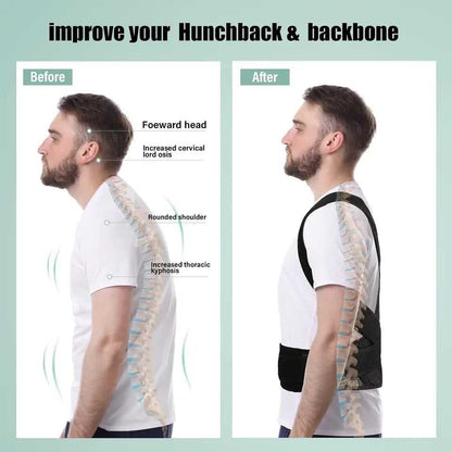 Instant Posture Corrector|Back Shoulder Neck Support Brace for Pain Relief